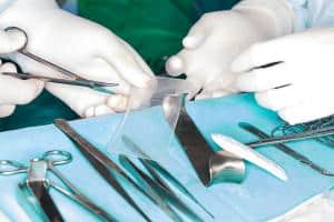 $255k Verdict for Pensacola Couple After Hernia Mesh Injury