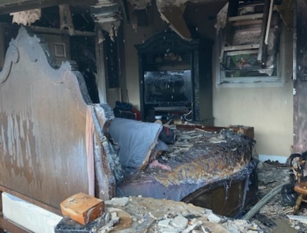 One Person Injured In Spring Hill House Fire